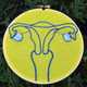 Illustration for article titled Women At Risk For Ovarian Cancer Have New Options, But No Easy Choices